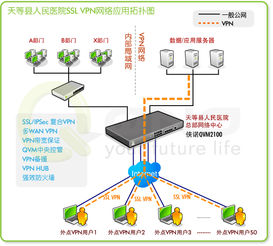 ѵH|SSL VPNΩݼ